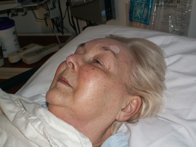 Mom resting after Gamma Knife